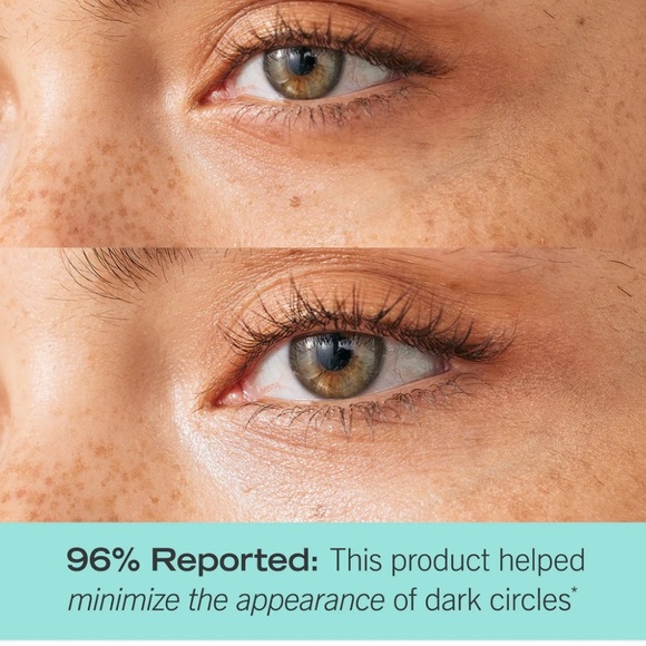 NIB•First Aid Beauty Brighten + Glow Eye Cream With Niacinamide - Picture 4 of 4